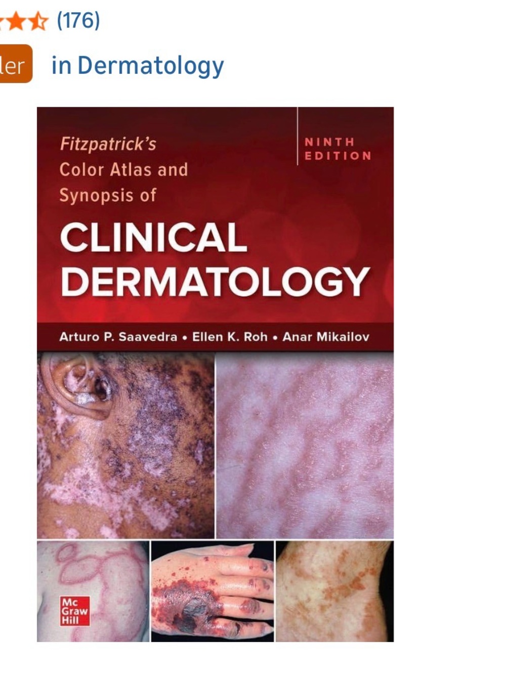 's Clinical Dermatology